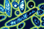 Legionella